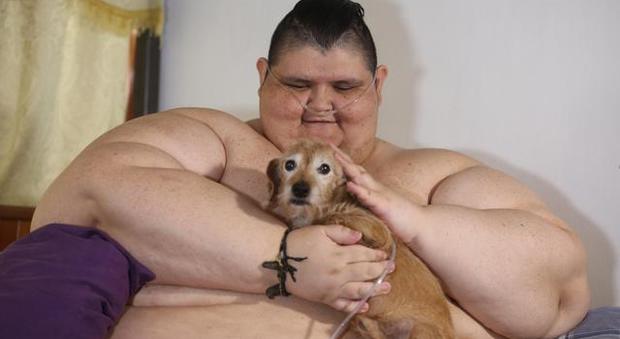 L'uomo più grasso del mondo? Juan Pedro: 595kg e ne ha persi 175