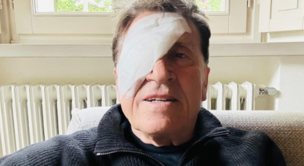 Gianni Morandi, la foto con l'occhio bendato: «Ho fatto a pugni»