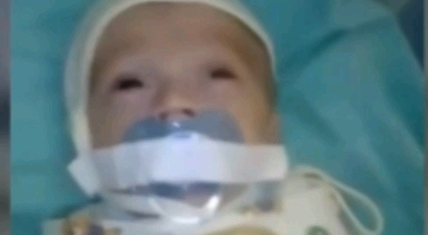 Neonato in ospedale legato alla culla, il ciuccio fermato con lo scotch: la video denuncia choc