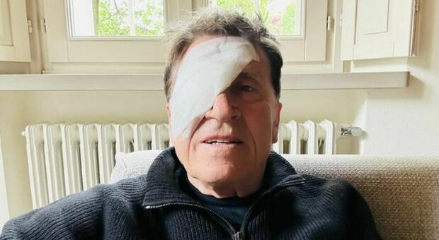 Gianni Morandi, foto choc con l'occhio bendato