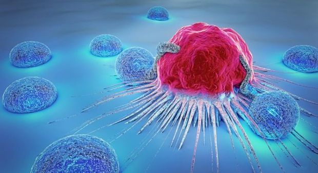 Cancro, cellule geneticamente modificate efficaci sul mieloma: un paziente già dimesso