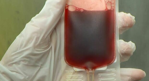 West Nile, trovato il virus nella sacca di sangue di un donatore