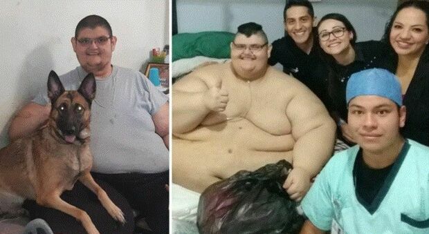L'uomo più grasso del mondo è dimagrito 300 chili: l'incredibile trasformazione di Juan Pedro Franco, ecco com'è oggi