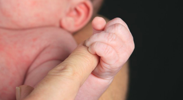 Scandalo maternità, indagine su oltre 1.700 casi di morti infantili e neonati feriti all'ospedale Nottingham