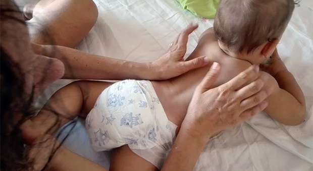 Mille insidie per i bimbi con il caldo: ecco i segreti per salvare la pelle