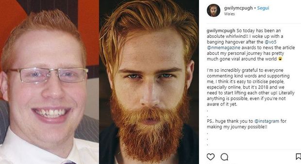 Da nerd e sovrappeso a sex symbol: come la barba gli ha cambiato la vita