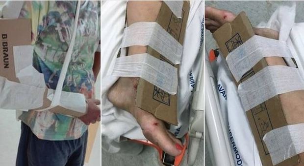 Pazienti "ingessati" con il cartone, i medici: «A Reggio Calabria come in tempo di guerra»