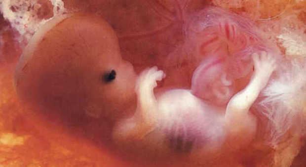 "Da embrioni malati nascono bimbi sani", il sorprendente risultato di una ricerca italiana