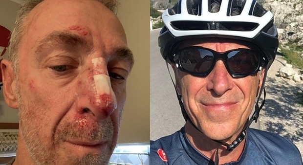 Milano, Linus cade dalla bici a causa di una radice: ferito