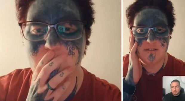 Drogata e tatuata dall'ex a 21 anni, oggi non trova lavoro: un volontario si propone di pagare la rimozione laser