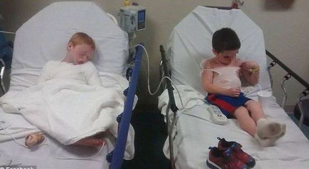 "La maestra non ci ha messo la crema", fratellini gravemente ustionati in ospedale
