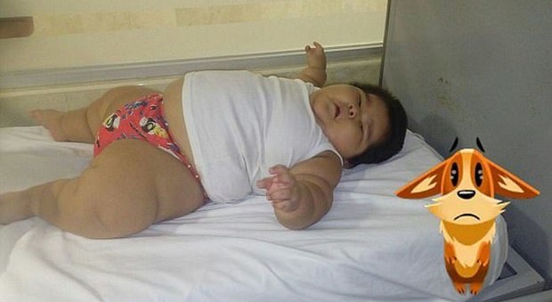 Ha 10 mesi ma pesa come un bimbo di 9 anni: Luis, 30 kg, rischia di morire