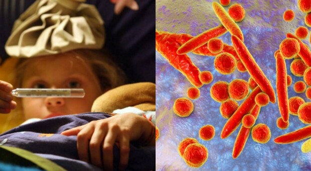 Polmonite bambini, i sintomi e come riconoscerli: d alla tosse all'inappetenza fino alle forme gravi