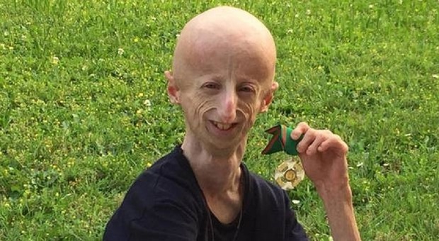 https://statics.cedscdn.it/photos/MED/81/96/8398196_06082536_sammy_basso_progeria_cos_e.jpg