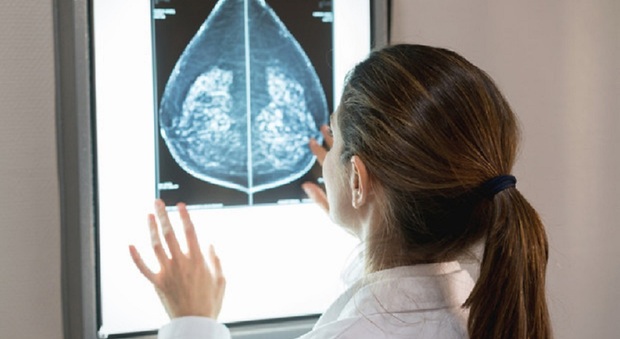 Tumore al seno ai primi stadi, un nuovo farmaco riduce il rischio di recidiva e metastasi