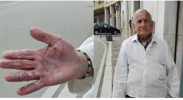 Scossa elettrica mentre aggiusta l'asciugacapelli, barbiere a 86 anni resta ustionato: «Ho pensato di morire»