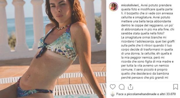 Micol Olivieri senza filtri sui social: «Ho smagliature e cellulite, ma amo il mio corpo»