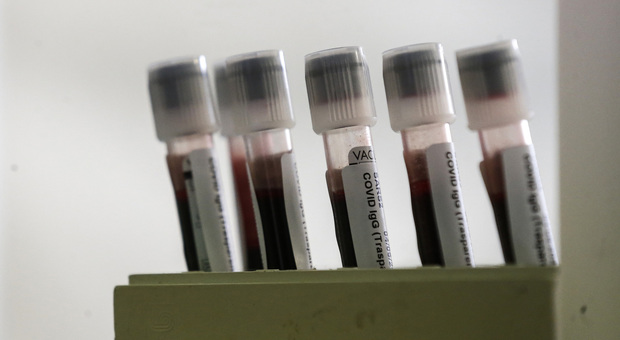 Coronavirus, 13 morti e 162 nuovi positivi nelle ultime 24 ore (63 in Lombardia)