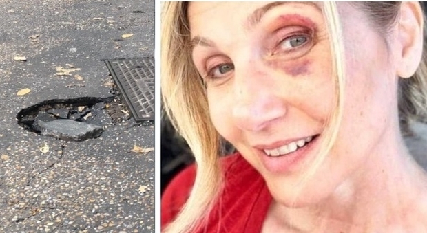 Lorella Cuccarini, caduta sul marciapiede e volto tumefatto: «Tutta colpa di una buca»