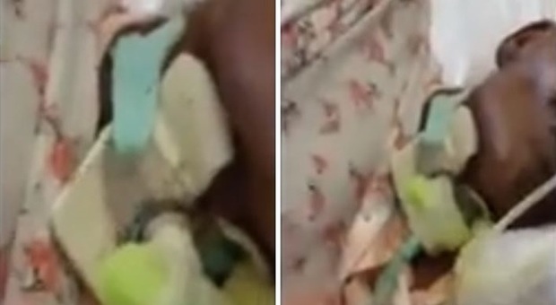 Napoli, donna ricoverata al San Giovanni Bosco ricoperta di formiche: il video choc