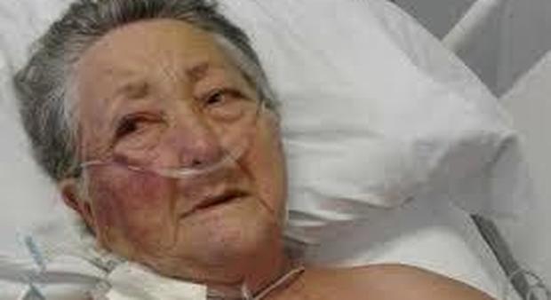 Brasile, anziana muore in ospedale dopo essere stata aggredita da un infermiere