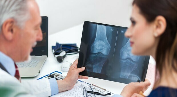 Osteoporosi, in italia 5 mln di malati: l'80% sono donne. Gli esperti: «Le fratture più comuni al femore e alle vertebre»