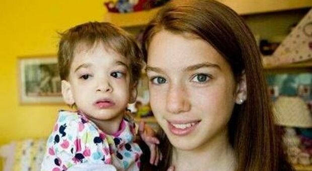 Morto Brooke, ventenne con l'aspetto di un bimbo di 2 anni: la sindrome del cromosoma X e la ricerca dell'immortalità biologica