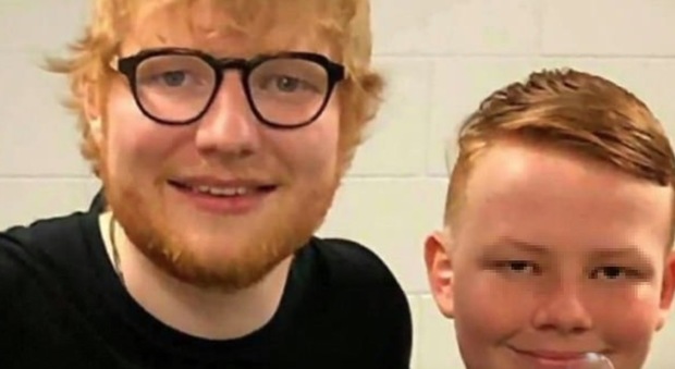 Picchiato dai bulli per i capelli rossi tenta il suicidio: Ed Sheeran sostiene la sua battaglia