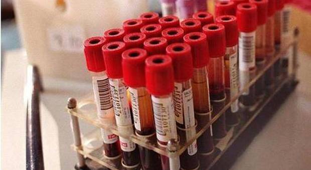 Sangue artificiale da cellule staminali: servirà per le trasfusioni in emergenza