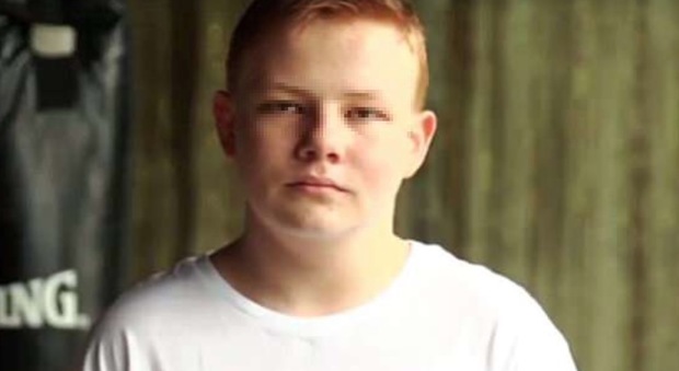 immagine Australia, perseguitato dai bulli per i capelli rossi tenta il suicidio: Ed Sheeran sostiene la sua battaglia contro le vessazioni