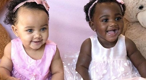 Nordamerica, le due gemelline con il colore della pelle diverso diventano delle star su Instagram