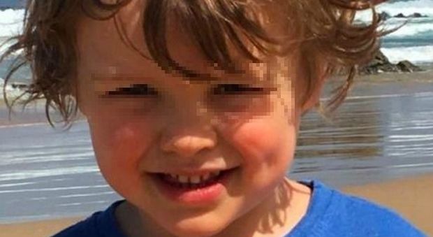 Bimbo di 5 anni rimane incastrato nel tubo della vasca da bagno Foto