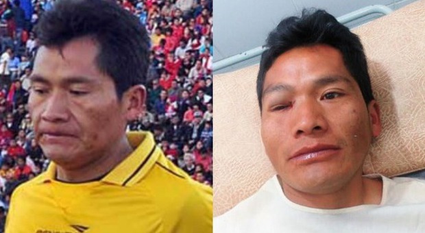 Choc in Bolivia, guardalinee accoltellato dai tifosi: la furia dopo un gol annullato per fuorigioco