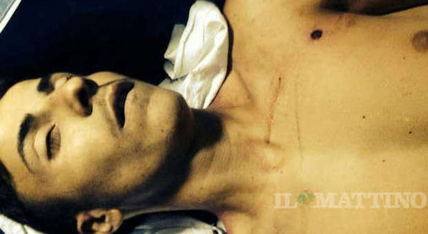 Ucciso da un carabiniere: la famiglia diffonde le foto choc del cadavere