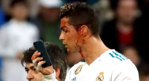 Ronaldo segna di testa ma si ferisce: poi col cellulare un selfie per controllare i danni