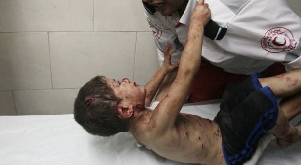 L'immagine choc del bimbo palestinese coperto di sangue: "Voglio mio padre"