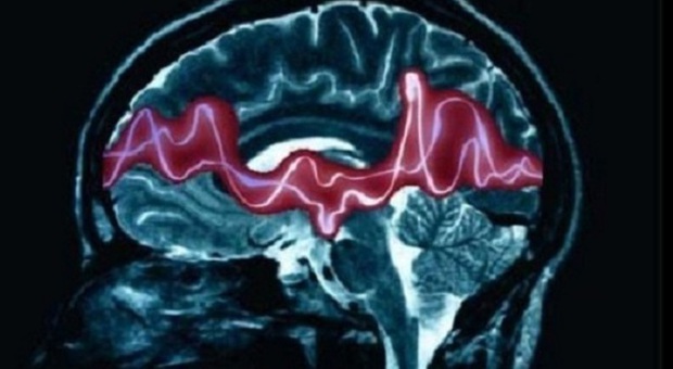 Epilessia, una nuova terapia può bloccare le crisi