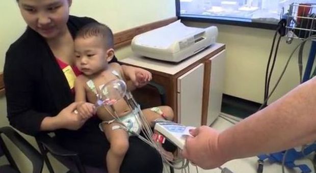 Roland, il bimbo di 14 mesi salvato da un cuore stampato in 3D