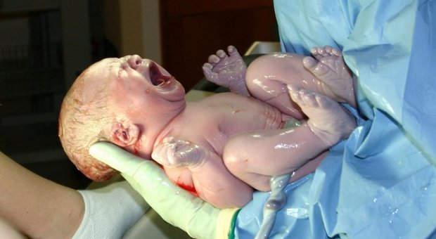 Due bimbi nati «con la camicia», evento rarissimo all'ospedale Fazzi di Lecce