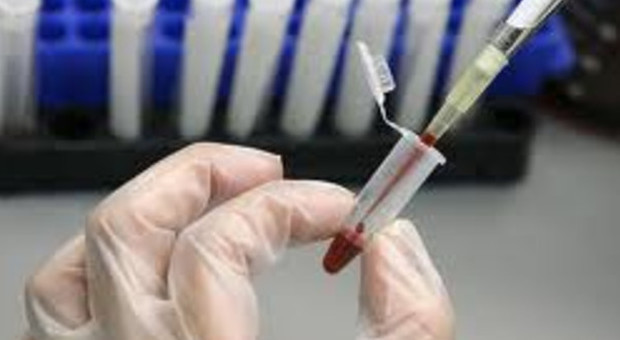 Un test del sangue calcolerà il rischio di morte entro cinque anni