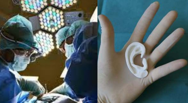 Orecchio stampato in 3D con cellule umane per "riparare" una malformazione: primo intervento al mondo