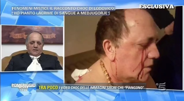 Lodovico: "Dopo la visita a Medjugorje piango lacrime di sangue"