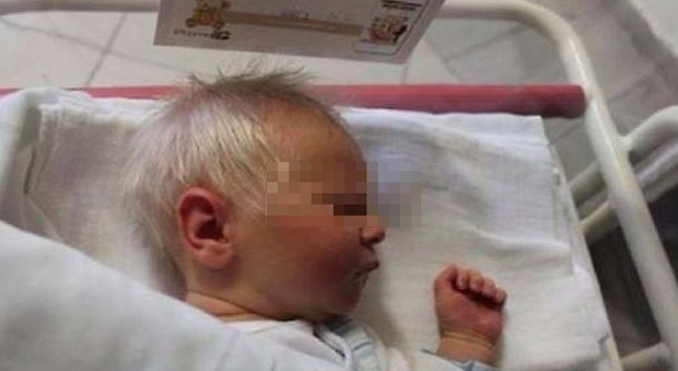 Bambino nasce con i capelli bianchi, ma non è albinismo: ecco cosa è successo