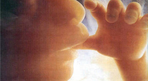 Neonata operata di cesareo dopo 24 ore dalla nascita: «Era incinta della sua gemella parassita»