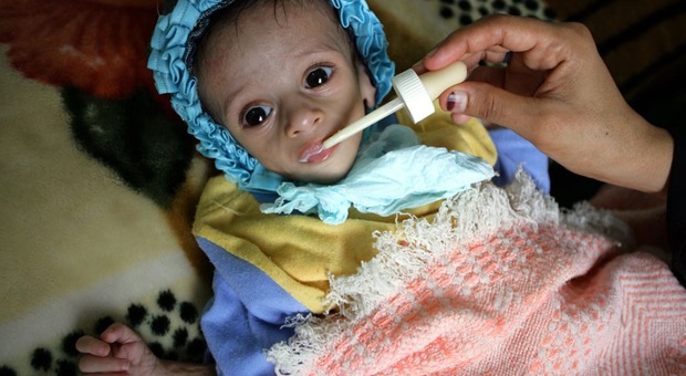 Yemen, 16 milioni di bambini e adulti ridotti alla fame: sos dalle Nazioni Unite