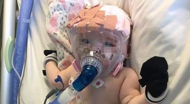 Coronavirus, bimba di 6 mesi lotta per la vita attaccata al respiratore dopo l'intervento a cuore aperto
