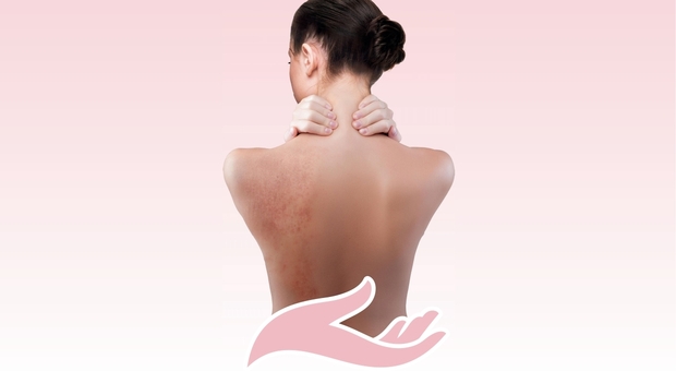 «Dalla parte della tua pelle», open day in tutta Italia per combattere la dermatite atopica
