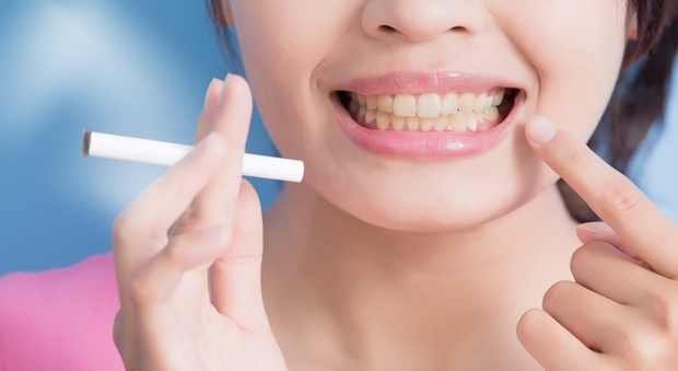 Il fumo è nemico degli impianti ai denti: raddoppia il rischio di fallimento