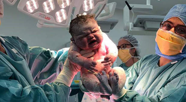 Australia, nasce di 6,05 kg entrando nella lista dei neonati più grandi del mondo