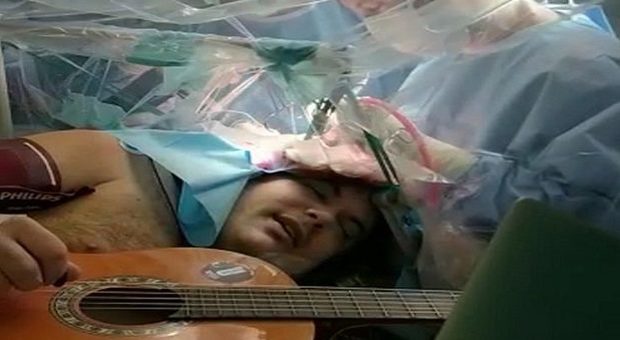 Torino, musicista suona chitarra e tamburello mentre viene operato al cervello: è la tecnica “asleep-awake”